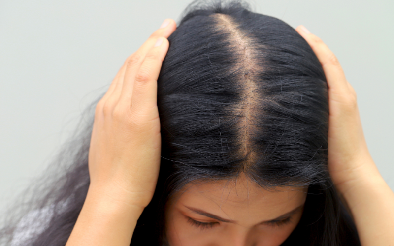 ¿Por qué se me cae el pelo en otoño?